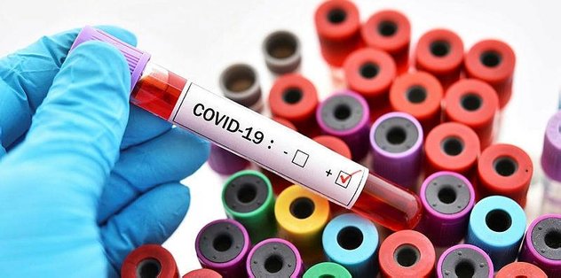 corona virusu testi pcr sonuc ogren corona virusu koronavirus test sonucu nasil ogrenilir e devlet e nabiz test sonuc ekrani fotomac