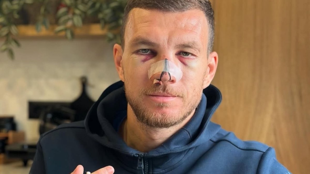 FENERBAHÇE HABERLERİ - Edin Dzeko'dan sakatlık paylaşımı! FENERBAHÇE HABERLERİ - Edin Dzeko'dan sakatlık paylaşımı!