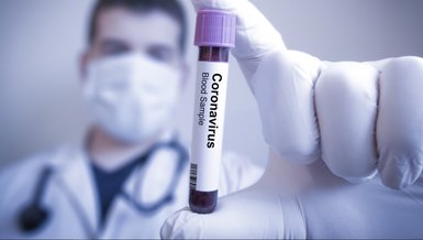 Corona virüsü yeni belirtileri ortaya çıktı! İshal ve mide bulantısı corona belirtisi mi?