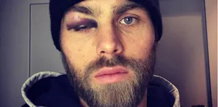 Elmander’in son hali şoke etti!