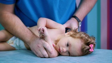SEREBRAL PALSI HASTALIĞI NEDİR? | Serebral Palsi hastalığı belirtileri nedir? Beyin felci nasıl anlaşılır?