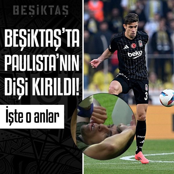 Beşiktaş’ta Gabriel Paulista’nın dişi kırıldı!