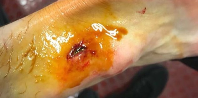 Galatasaraylı Martin Linnes'in ayaÄı sosyal medyayı salladı!