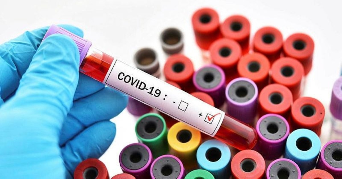 corona virusu testi pcr sonuc ogren corona virusu koronavirus test sonucu nasil ogrenilir e devlet e nabiz test sonuc ekrani fotomac