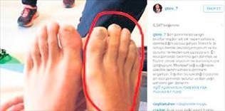 Sağ ayağımdaki sakatlık geçmedi