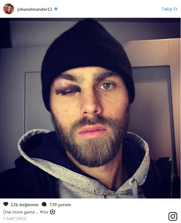 Elmander'in son hali şoke etti! - 1