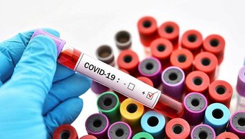 Corona virüsü (Koronavirüs) test sonucu nasıl öğrenilir?