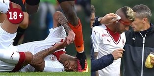 Kulağının bir kısmı koptu