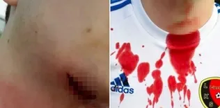 Futbol terörü! Boğazını bıçakla kesti!