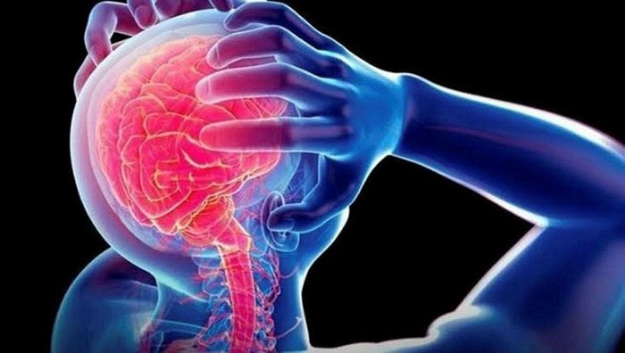 kume-bas-agrisi-cluster-headache-nedir-kume-bas-agrisi-belirtileri-nedir-tedavisi-var-mi-neden-olur-genetik-mi-1690783406584.jpeg