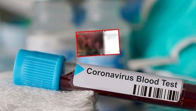 Jorge Jesus'un koronavirüs test sonucu negatif çıktı