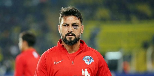 Ramazan Köse’nin gözündeki morluk dikkat çekti