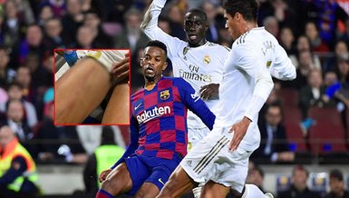 Madrid'li yıldızın bacağının son hali şoke etti!