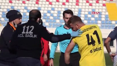 >Futbol maçında ilginç olay! Oyuncuyu arı soktu
