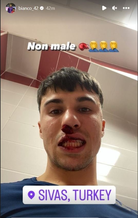 Sivas''ta Fiorentina''lı futbolcuya saldırı! Sahaya giren taraftar yumruk  attı - Fotomaç