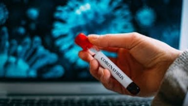 Fransa'da Klorokin tedavisi uygulanan hastaların yüzde 91,7'si iyileşti! Klorokin nedir?