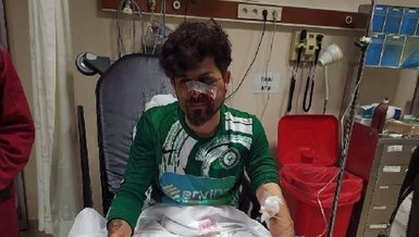 SPOR HABERİ - Kırmızı kart gören futbolcu yerde yatan rakibinin yüzüne tekme atıp yaraladı!