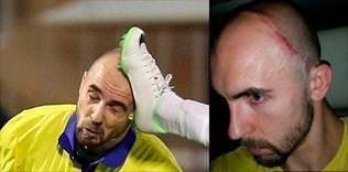 Adrian'a ölümcül tekme