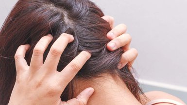 SAÇKIRAN (ALOPESI UNIVERSALIS) NEDİR? | Saçkıran belirtileri neler, tedavisi var mı, öldürür mü?