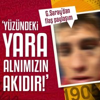 G.Saray: Yüzündeki yara alnımızın akıdır!