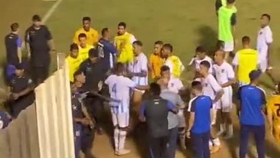 >Brezilya'da korkunç olay! Polis futbolcuyu bacağından vurdu