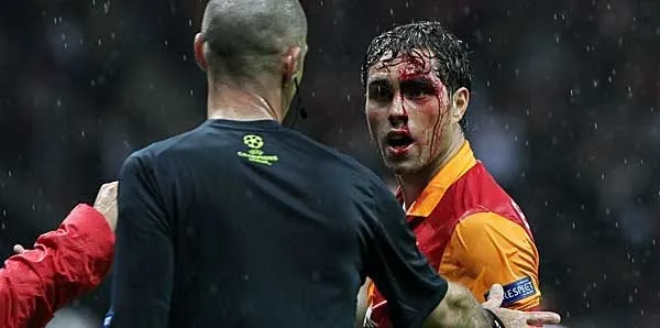 Elmander'in son hali şoke etti! - 2