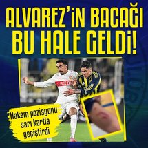 <p>UEFA Avrupa Ligi'nin 3. haftasında Fenerbahçe, sahasında Alman ekibi Stuttgart'ı ağırladı. Mücadelenin 22. dakikasında Stuttgartlı futbolcu Bilal El Khannouss, Fenerbahçeli Edson Alvarez'e son derece sert bir müdahalede bulundu.</p>
<p>Hakem Jakob Kehlet, pozisyonu sarı kartla cezalandırmakla yetindi. Ancak karar, hem tribünlerden hem de teknik ekipten büyük tepki topladı.</p>
<p>Devre arasında Fenerbahçe soyunma odasından gelen görüntüler ise müdahalenin ne kadar ağır olduğunu gözler önüne serdi. Görüntülerde, El Khannouss'un krampon darbesi sonucu Edson Alvarez'in bacağında derin bir yara oluştuğu görüldü.</p>
<p><strong>İŞTE O GÖRÜNTÜLER</strong></p>
<p><img alt="" data-pimg="https://iaftm.tmgrup.com.tr/077e64/0/0/0/0/958/1280?u=https://iftm.tmgrup.com.tr/2025/10/23/fenerbahce-haberi-alvarezin-bacagi-yara-icinde-kaldi-hakem-pozisyonu-sari-kartla-gecistirdi-1761243289461.jpg&mw=1366" src="https://iaftm.tmgrup.com.tr/e51fd1/0/0/0/0/958/1280?u=https://iftm.tmgrup.com.tr/2025/10/23/fenerbahce-haberi-alvarezin-bacagi-yara-icinde-kaldi-hakem-pozisyonu-sari-kartla-gecistirdi-1761243289461.jpg&mw=800" style="height:1069px; width:800px"></p>
<p><img alt="" data-pimg="https://iaftm.tmgrup.com.tr/d75cdc/0/0/0/0/960/1280?u=https://iftm.tmgrup.com.tr/2025/10/23/fenerbahce-haberi-alvarezin-bacagi-yara-icinde-kaldi-hakem-pozisyonu-sari-kartla-gecistirdi-1761243313977.jpg&mw=1366" src="https://iaftm.tmgrup.com.tr/3b3a40/0/0/0/0/960/1280?u=https://iftm.tmgrup.com.tr/2025/10/23/fenerbahce-haberi-alvarezin-bacagi-yara-icinde-kaldi-hakem-pozisyonu-sari-kartla-gecistirdi-1761243313977.jpg&mw=800" style="height:1067px; width:800px"></p>
<p><img alt="" data-pimg="https://iaftm.tmgrup.com.tr/19f18e/0/0/0/0/1280/765?u=https://iftm.tmgrup.com.tr/2025/10/23/fenerbahce-haberi-alvarezin-bacagi-yara-icinde-kaldi-hakem-pozisyonu-sari-kartla-gecistirdi-1761243339268.jpg&mw=1366" src="https://iaftm.tmgrup.com.tr/cc54af/0/0/0/0/1280/765?u=https://iftm.tmgrup.com.tr/2025/10/23/fenerbahce-haberi-alvarezin-bacagi-yara-icinde-kaldi-hakem-pozisyonu-sari-kartla-gecistirdi-1761243339268.jpg&mw=800" style="height:478px; width:800px"></p>