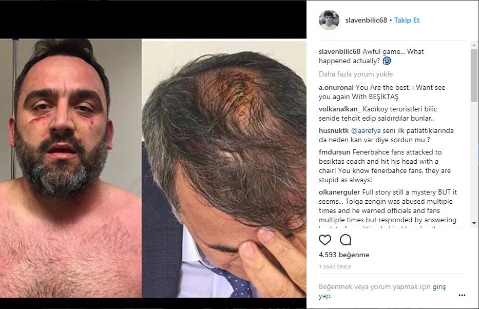 Bilic Korkunc Oyun Ne Oluyor Son Dakika Fenerbahce Haberleri Fotomac